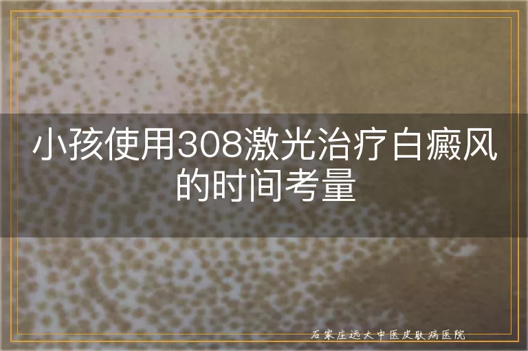 小孩使用308激光治疗白癜风的时间考量