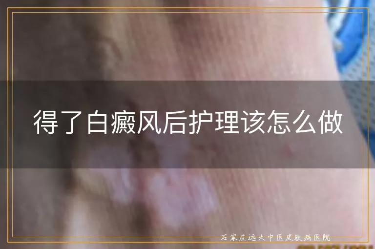 得了白癜风后护理该怎么做