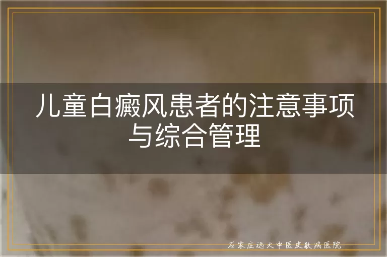 儿童白癜风患者的注意事项与综合管理