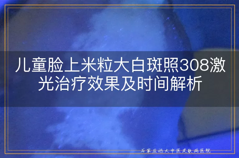 儿童脸上米粒大白斑照308激光治疗效果及时间解析