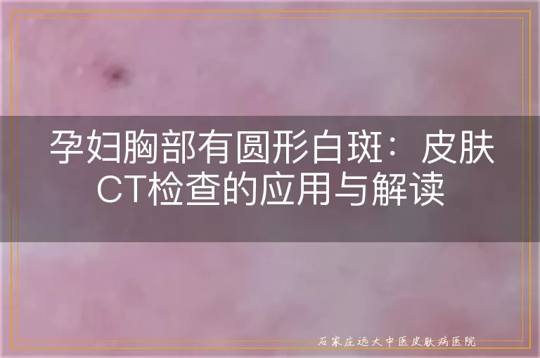 孕妇胸部有圆形白斑：皮肤CT检查的应用与解读