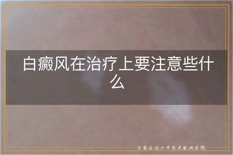 白癜风在治疗上要注意些什么