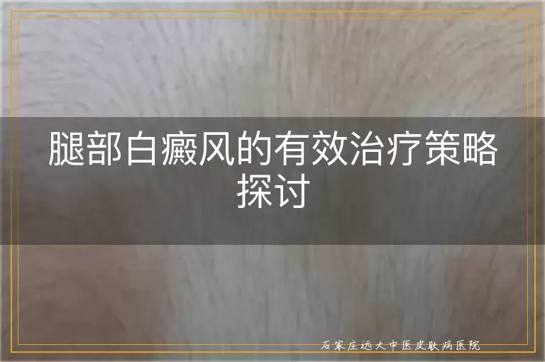 腿部白癜风的有效治疗策略探讨