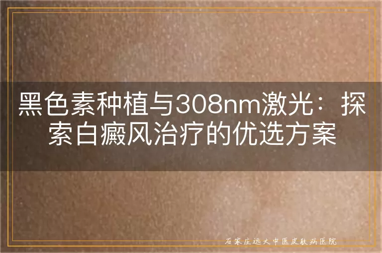 黑色素种植与308nm激光：探索白癜风治疗的优选方案