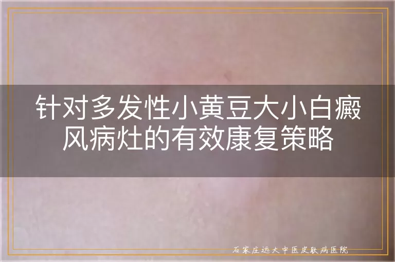 针对多发性小黄豆大小白癜风病灶的有效康复策略
