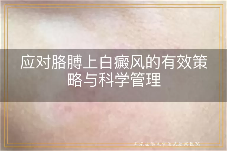 应对胳膊上白癜风的有效策略与科学管理