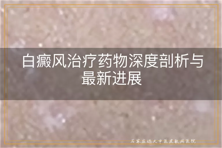 白癜风治疗药物深度剖析与最新进展