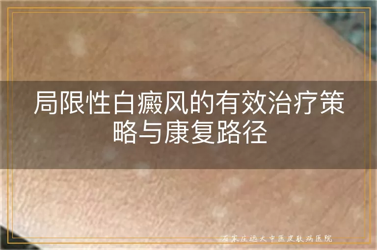 局限性白癜风的有效治疗策略与康复路径
