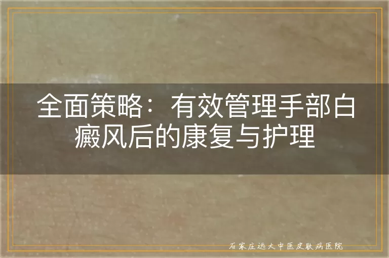 全面策略：有效管理手部白癜风后的康复与护理