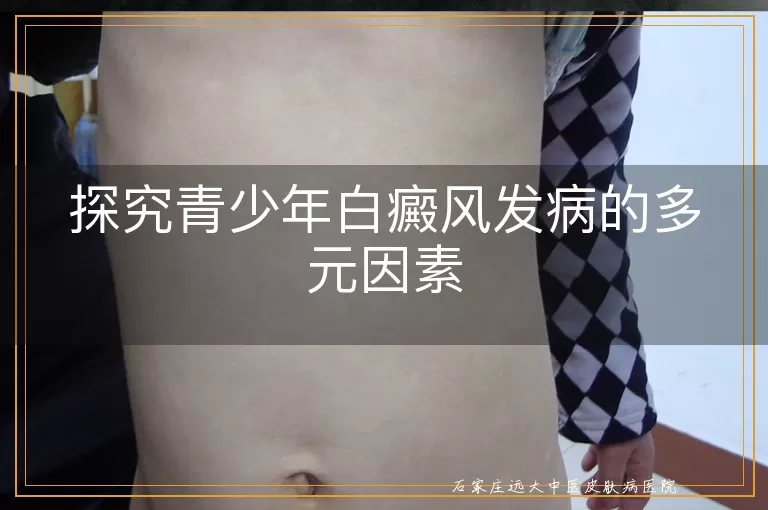 探究青少年白癜风发病的多元因素