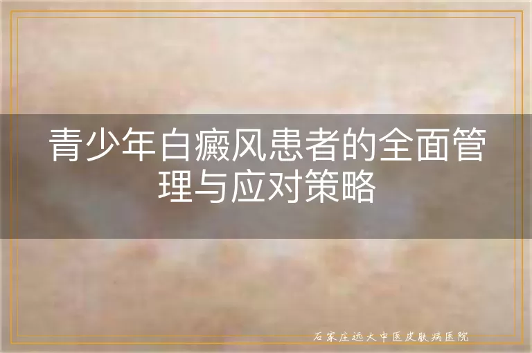 青少年白癜风患者的全面管理与应对策略