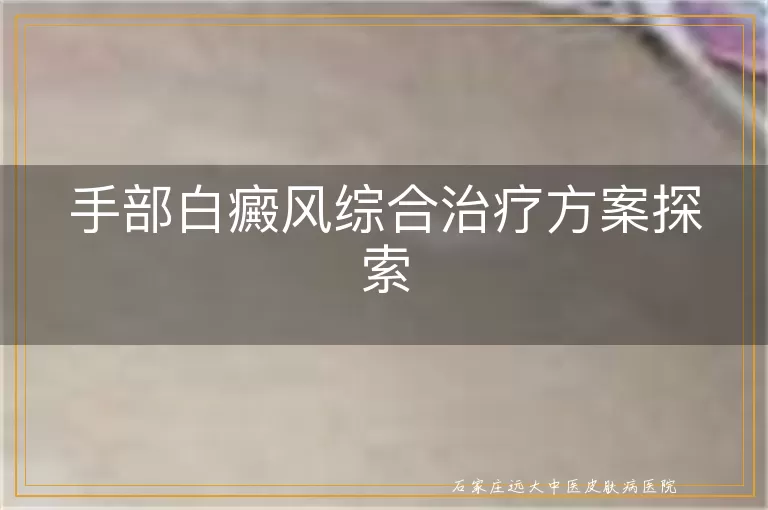 手部白癜风综合治疗方案探索