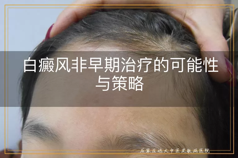 白癜风非早期治疗的可能性与策略