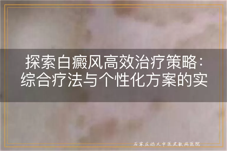 探索白癜风高效治疗策略：综合疗法与个性化方案的实践