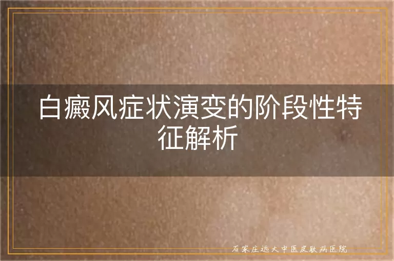 白癜风症状演变的阶段性特征解析