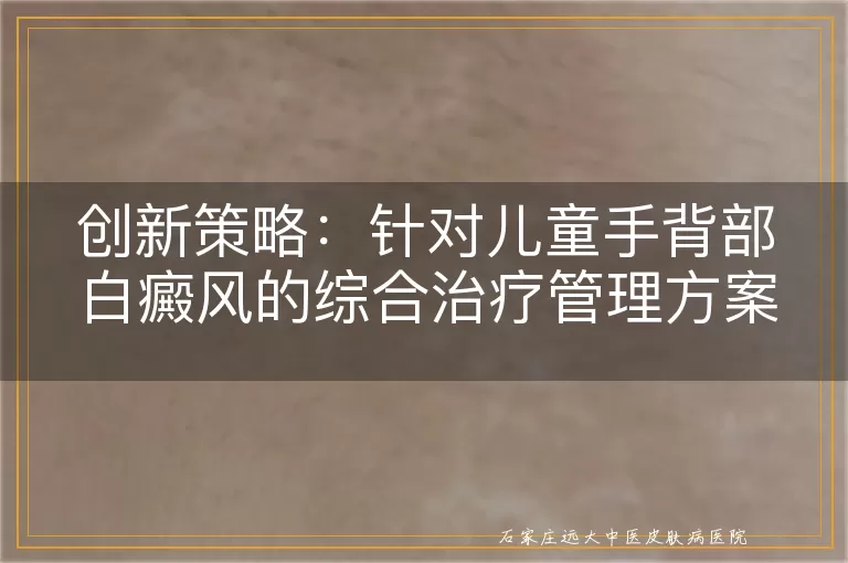 创新策略：针对儿童手背部白癜风的综合治疗管理方案