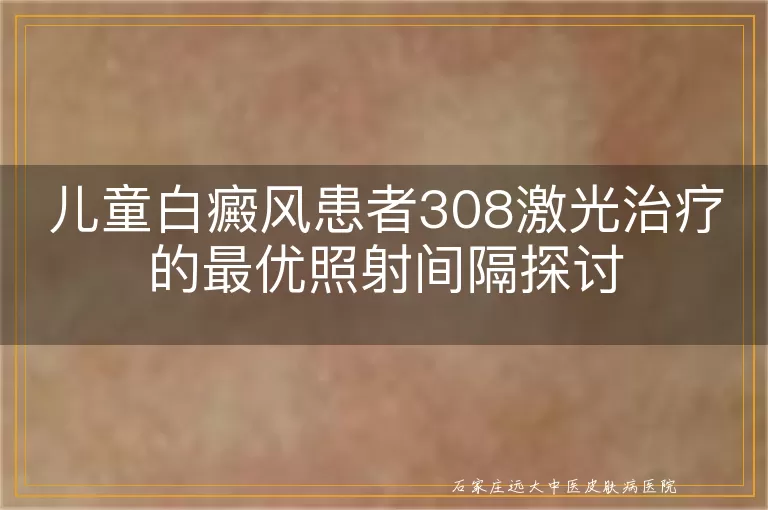 儿童白癜风患者308激光治疗的最优照射间隔探讨