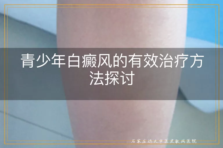 青少年白癜风的有效治疗方法探讨