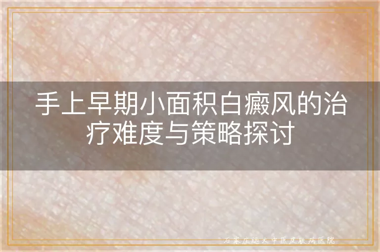 手上早期小面积白癜风的治疗难度与策略探讨