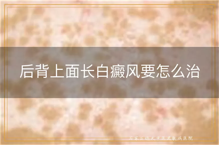 后背上面长白癜风要怎么治