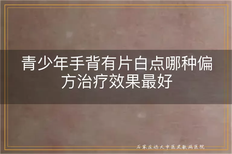 青少年手背有片白点哪种偏方治疗效果最好