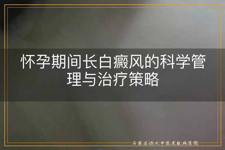 怀孕期间长白癜风的科学管理与治疗策略