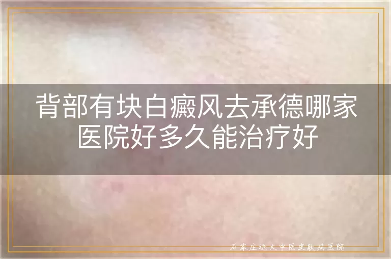 背部有块白癜风去承德哪家医院好多久能治疗好