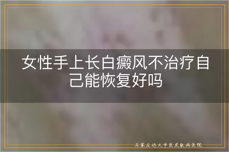 女性手上长白癜风不治疗自己能恢复好吗