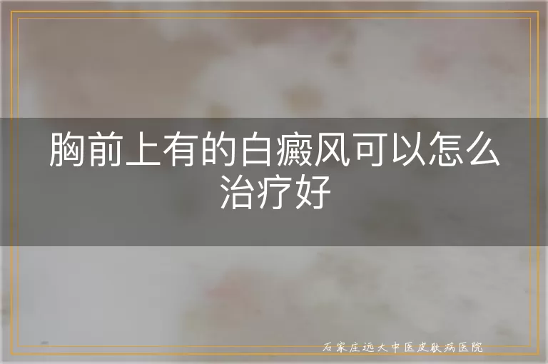 胸前上有的白癜风可以怎么治疗好