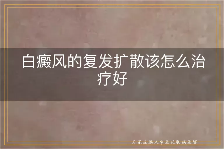 白癜风的复发扩散该怎么治疗好