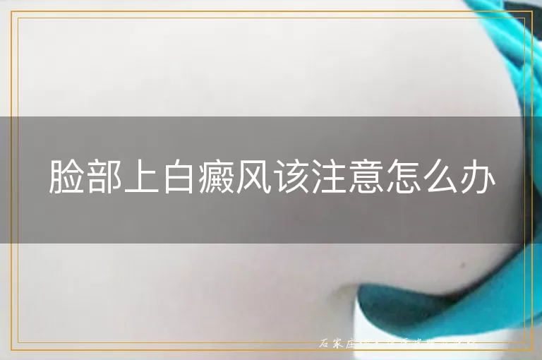 脸部上白癜风该注意怎么办