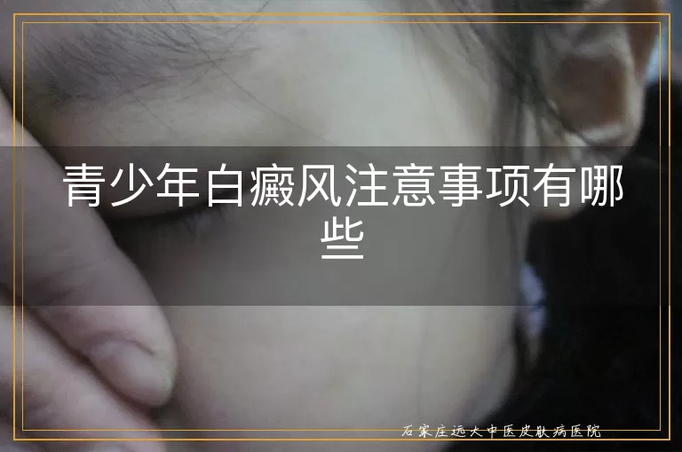 青少年白癜风注意事项有哪些