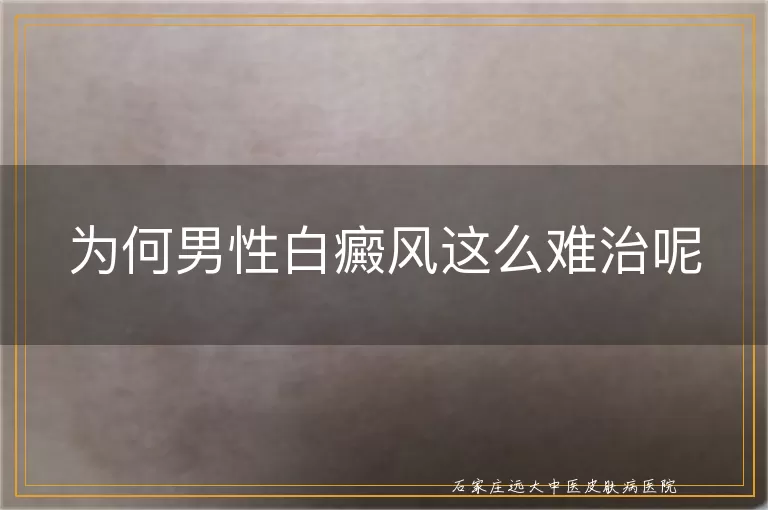 为何男性白癜风这么难治呢