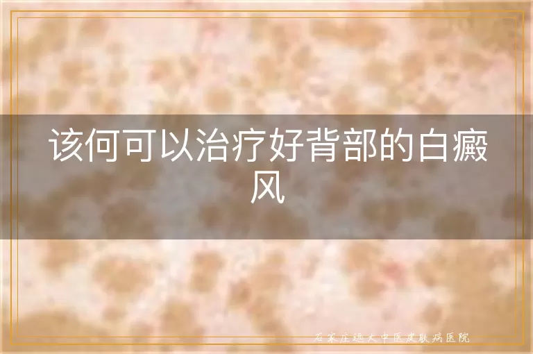 该何可以治疗好背部的白癜风