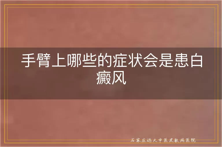 手臂上哪些的症状会是患白癜风