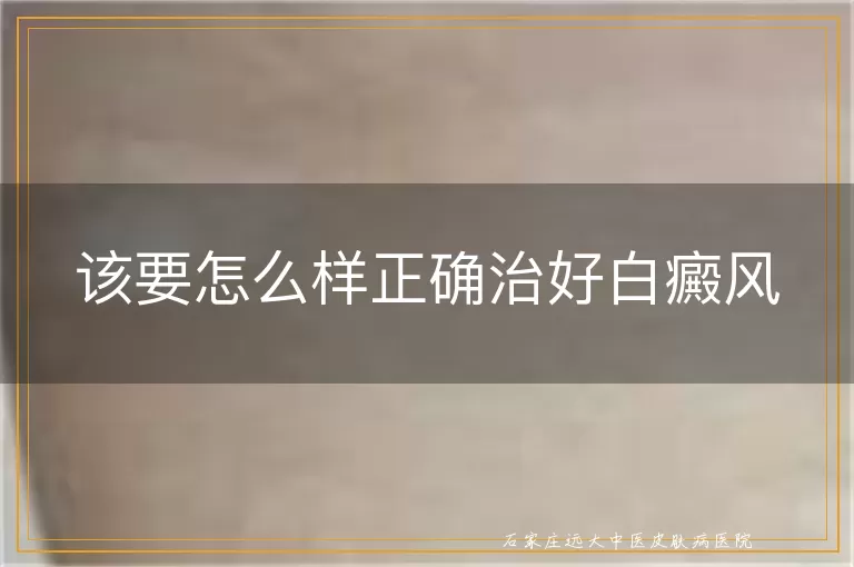 该要怎么样正确治好白癜风