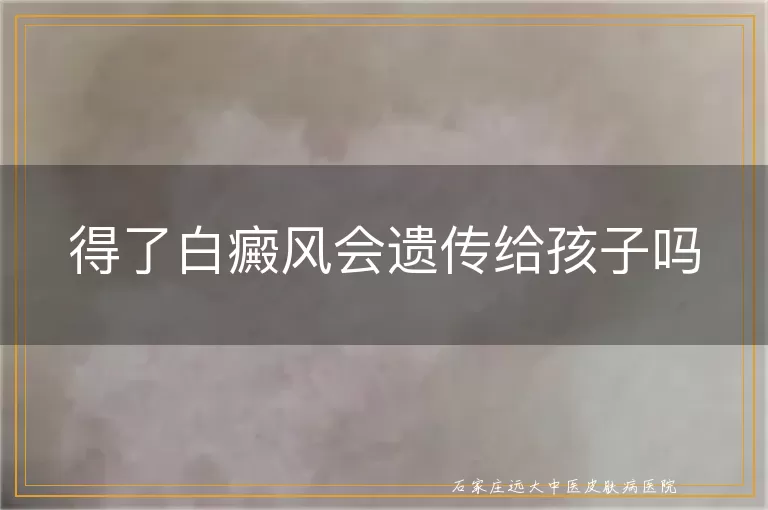 得了白癜风会遗传给孩子吗