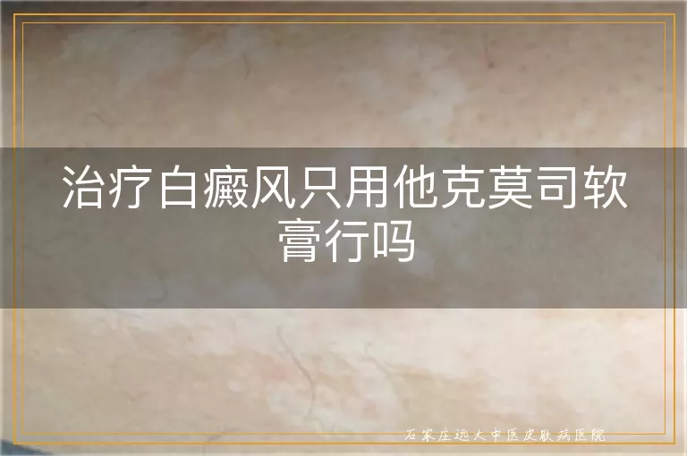 治疗白癜风只用他克莫司软膏行吗