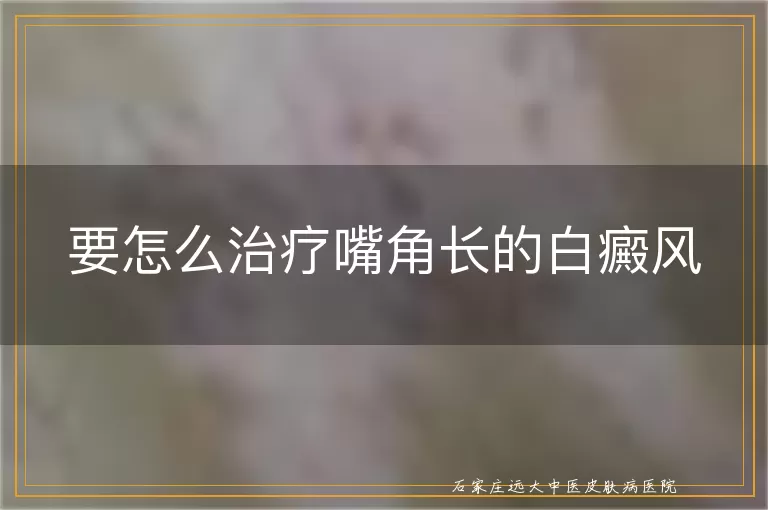 要怎么治疗嘴角长的白癜风