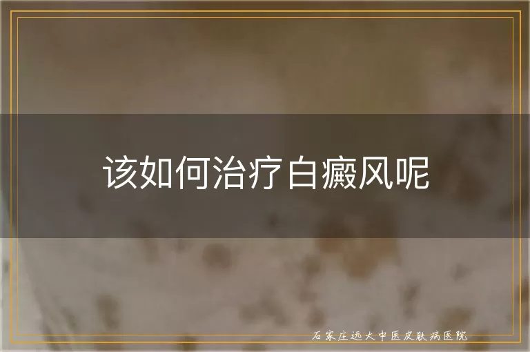 该如何治疗白癜风呢