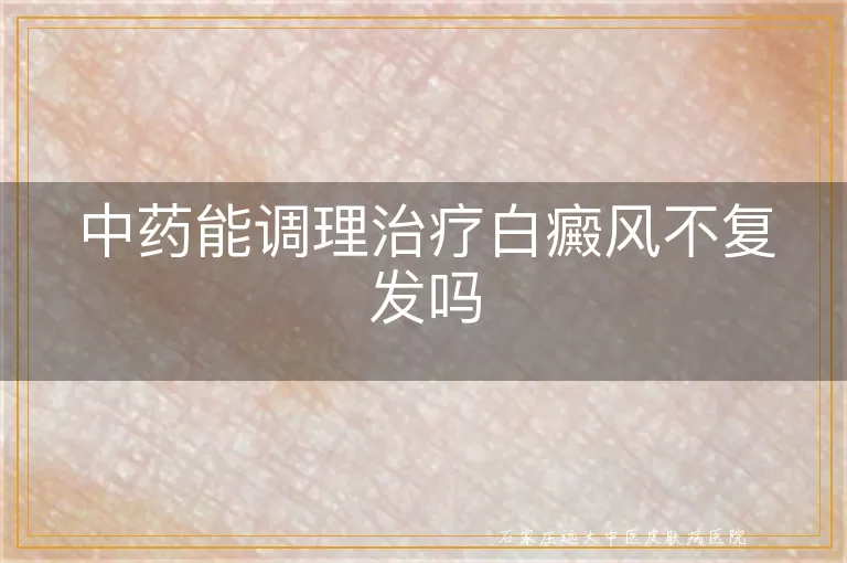 中药能调理治疗白癜风不复发吗