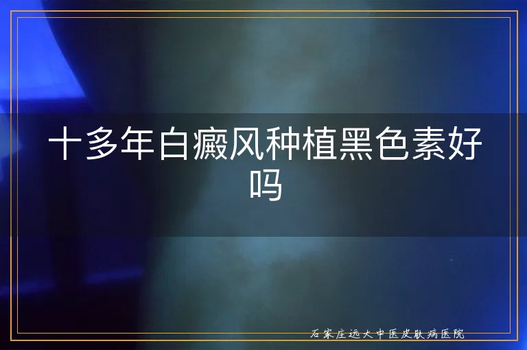 十多年白癜风种植黑色素好吗