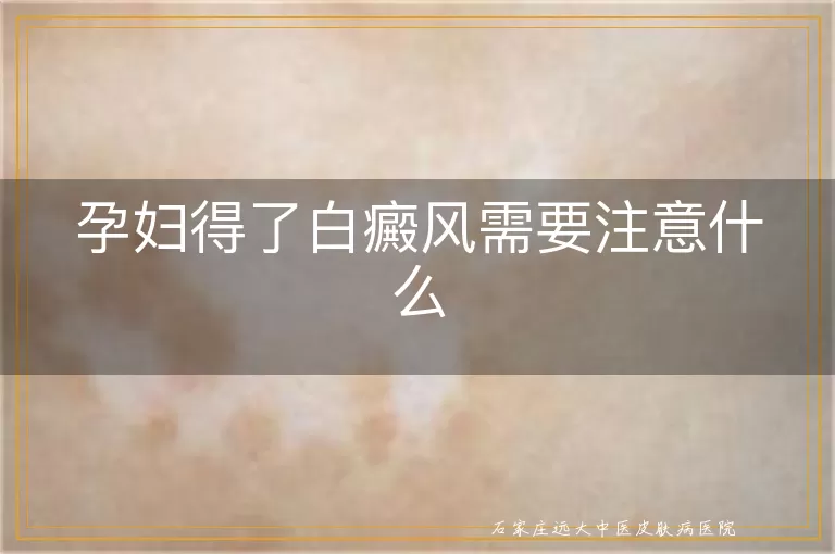 孕妇得了白癜风需要注意什么
