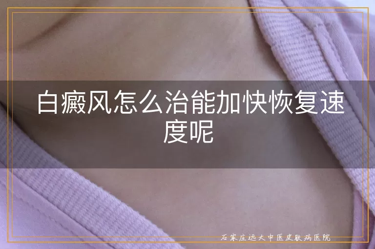 白癜风怎么治能加快恢复速度呢