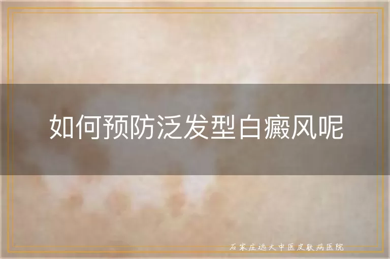 如何预防泛发型白癜风呢