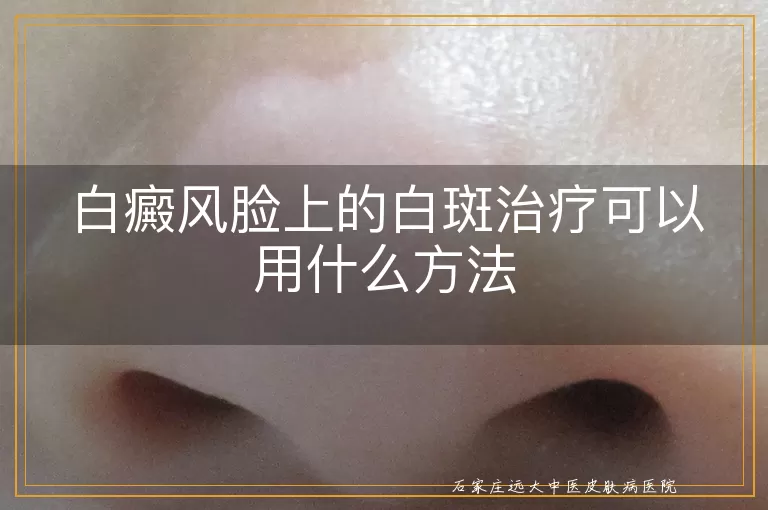 白癜风脸上的白斑治疗可以用什么方法