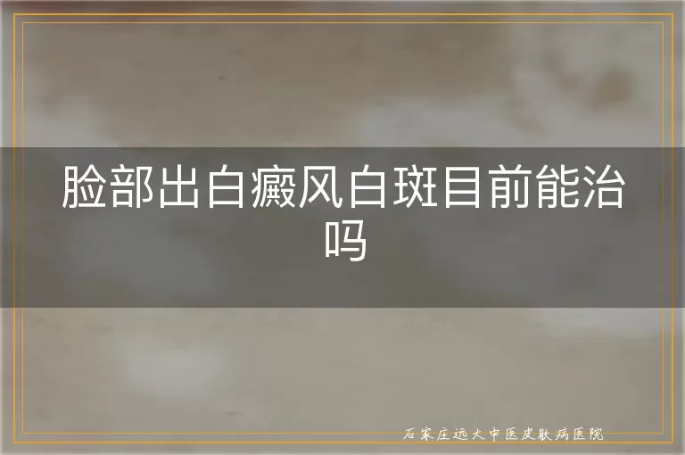 脸部出白癜风白斑目前能治吗