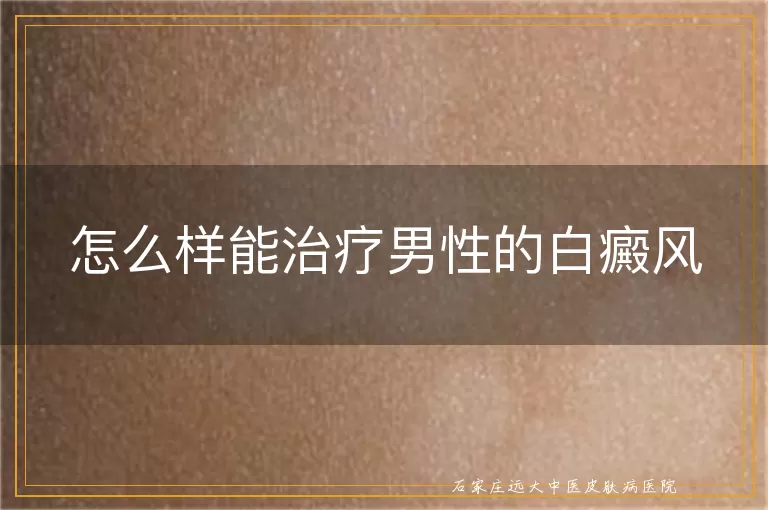 怎么样能治疗男性的白癜风