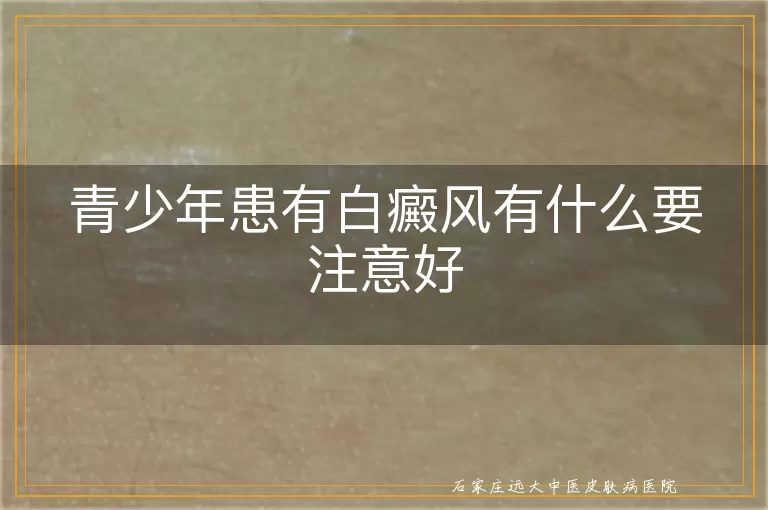 青少年患有白癜风有什么要注意好