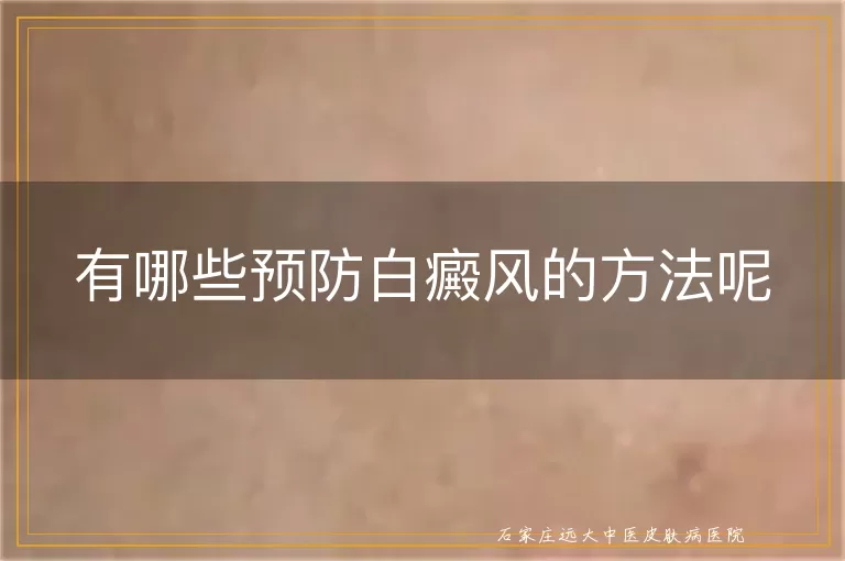 有哪些预防白癜风的方法呢